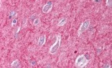 Anti-ICAM5 precursor antibody, C-term used in IHC (Paraffin sections) (IHC-P). GTX89232