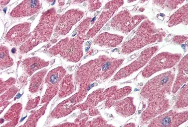 Anti-CPT1A antibody, Internal used in IHC (Paraffin sections) (IHC-P). GTX89237