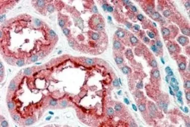 Anti-CPT1A antibody, Internal used in IHC (Paraffin sections) (IHC-P). GTX89237