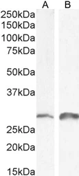 Anti-SNAI1 antibody, N-term used in Western Blot (WB). GTX89239