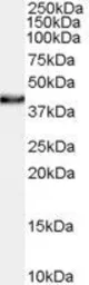 Anti-XLF antibody, C-term used in Western Blot (WB). GTX89244