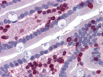 Anti-FLAP antibody, Internal used in IHC (Paraffin sections) (IHC-P). GTX89246