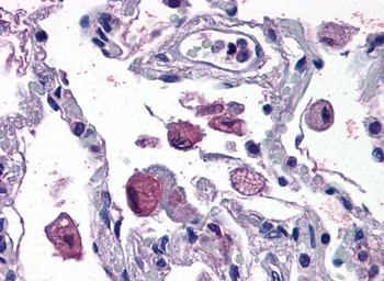 Anti-FLAP antibody, Internal used in IHC (Paraffin sections) (IHC-P). GTX89246