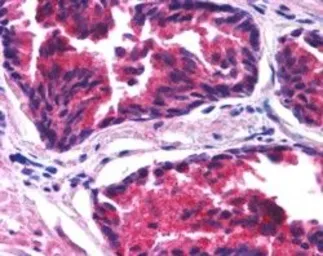 Anti-SNX26 / TCGAP antibody, N-term used in IHC (Paraffin sections) (IHC-P). GTX89249
