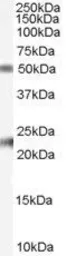 Anti-Fibulin 5 antibody, Internal used in Western Blot (WB). GTX89251