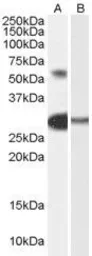 Anti-TCFL5 antibody, Internal used in Western Blot (WB). GTX89254