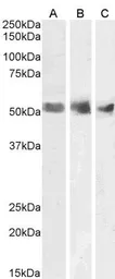 Anti-Wilms Tumor 1 antibody, N-term used in Western Blot (WB). GTX89257