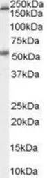 Anti-5-HT3A receptor antibody, Internal used in Western Blot (WB). GTX89260