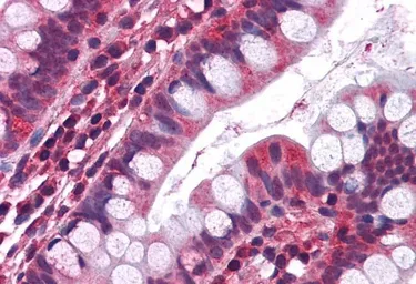 Anti-5-HT3A receptor antibody, Internal used in IHC (Paraffin sections) (IHC-P). GTX89260