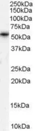 Anti-TPTE antibody, Internal used in Western Blot (WB). GTX89267