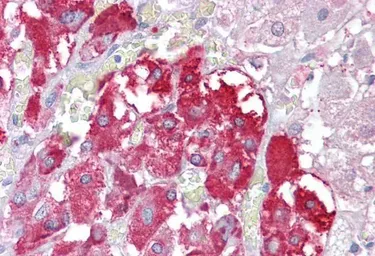 Anti-TPTE antibody, Internal used in IHC (Paraffin sections) (IHC-P). GTX89267