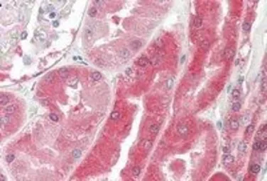 Anti-Von Hippel Lindau antibody, Internal used in IHC (Paraffin sections) (IHC-P). GTX89268