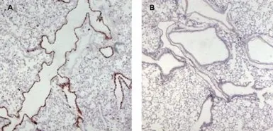 Anti-Munc 13-4 antibody, Internal used in IHC (Paraffin sections) (IHC-P). GTX89269
