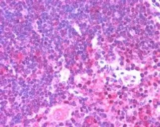 Anti-Munc 13-4 antibody, Internal used in IHC (Paraffin sections) (IHC-P). GTX89269