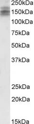 Anti-DSCAM antibody, Internal used in Western Blot (WB). GTX89275