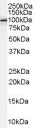 Anti-FE65 antibody, C-term used in Western Blot (WB). GTX89278