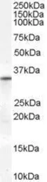 Anti-VDAC2 antibody, Internal used in Western Blot (WB). GTX89279