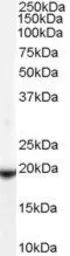 Anti-GPX4 (Isoform a and c) antibody, C-term used in Western Blot (WB). GTX89281