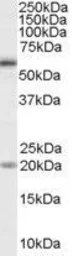 Anti-BMPR1A antibody, Internal used in Western Blot (WB). GTX89282