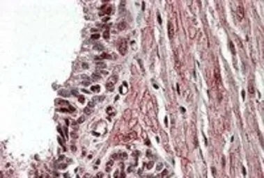 Anti-ZNF217 antibody, Internal used in IHC (Paraffin sections) (IHC-P). GTX89283