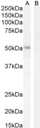Anti-LEF1 antibody, Internal used in Western Blot (WB). GTX89284