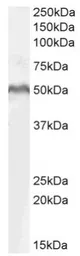 Anti-LEF1 antibody, Internal used in Western Blot (WB). GTX89284