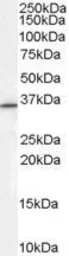 Anti-RNF115 antibody, Internal used in Western Blot (WB). GTX89285