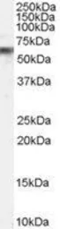 Anti-VPS45 antibody, C-term used in Western Blot (WB). GTX89286