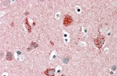 Anti-Munc18-1 antibody, C-term used in IHC (Paraffin sections) (IHC-P). GTX89288
