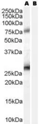Anti-EBAG9 antibody, C-term used in Western Blot (WB). GTX89290