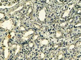 Anti-Tensin 1 antibody, C-term used in IHC (Paraffin sections) (IHC-P). GTX89292