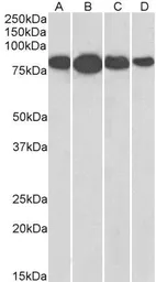 Anti-Radixin antibody, Internal used in Western Blot (WB). GTX89297