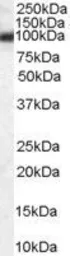 Anti-GRP94 antibody, Internal used in Western Blot (WB). GTX89299