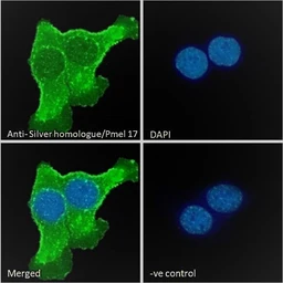 Anti-Melanoma gp100 antibody, C-term used in Immunocytochemistry/ Immunofluorescence (ICC/IF). GTX89304