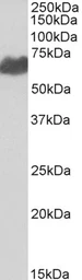 Anti-Melanoma gp100 antibody, C-term used in Western Blot (WB). GTX89304