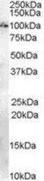 Anti-Anillin antibody, Internal used in Western Blot (WB). GTX89306