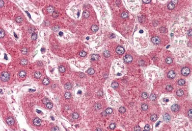 Anti-ROBO1 antibody, Internal used in IHC (Paraffin sections) (IHC-P). GTX89308