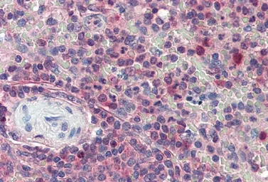 Anti-Importin beta 1 antibody, C-term used in IHC (Paraffin sections) (IHC-P). GTX89314