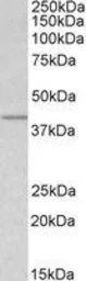 Anti-Wnt3 antibody, Internal used in Western Blot (WB). GTX89319