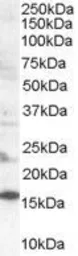 Anti-SH2D1A antibody, Internal used in Western Blot (WB). GTX89320