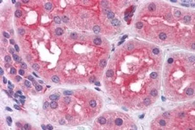 Anti-Prolyl Endopeptidase antibody, Internal used in IHC (Paraffin sections) (IHC-P). GTX89322
