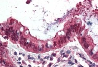 Anti-Ezrin antibody, Internal used in IHC (Paraffin sections) (IHC-P). GTX89327