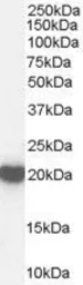 Anti-PRX II antibody, C-term used in Western Blot (WB). GTX89331