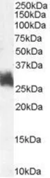 Anti-FRA1 antibody, Internal used in Western Blot (WB). GTX89333