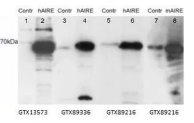 Anti-AIRE (isoform 1) antibody, Internal used in Western Blot (WB). GTX89336