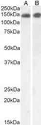 Anti-Leptin Receptor antibody, Internal used in Western Blot (WB). GTX89338