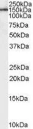 Anti-Leptin Receptor antibody, Internal used in Western Blot (WB). GTX89338