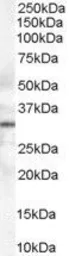 Anti-Syntaxin 6 antibody, Internal used in Western Blot (WB). GTX89342