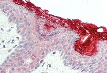 Anti-PERP antibody, C-term used in IHC (Paraffin sections) (IHC-P). GTX89344