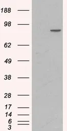 Anti-alpha 1 Catenin antibody, Internal used in Western Blot (WB). GTX89347